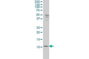 S100A4 monoclonal antibody (M01), clone 1F12-1G7 Western Blot analysis of S100A4 expression in Hela . (s100a4 anticorps  (AA 1-101))
