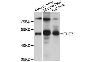 Western blot analysis of extracts of various cell lines, using FUT7 Antibody (ABIN5995907) at 1/1000 dilution. (FUT7 anticorps)