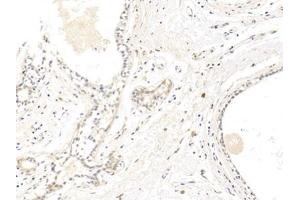 Detection of CLDN1 in Human Mammary gland Tissue using Polyclonal Antibody to Claudin 1 (CLDN1)