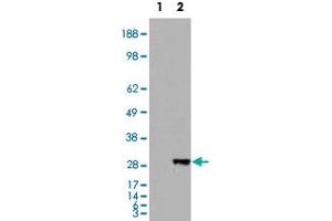 HEK293 overexpressing BDH2 and probed with BDH2 polyclonal antibody  (mock transfection in first lane), tested by Origene. (BDH2 anticorps  (Internal Region))