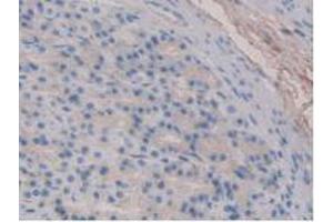 IHC-P analysis of Rat Stomach Tissue, with DAB staining. (Fibrillin 1 anticorps  (AA 751-895))