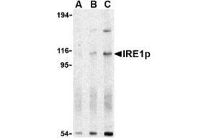 Western blot analysis of IRE1p in A-20 cell lysate with AP30445PU-N IRE1p antibody at (A) 0. (ERN1 anticorps  (N-Term))