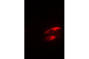 Immunofluorescent analysis of Focal Adhesion Kinase (pY925) staining in NIH3T3 cells.