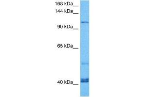 Host:  Mouse  Target Name:  KIF23  Sample Tissue:  Mouse Spleen  Antibody Dilution:  1ug/ml (KIF23 anticorps  (Middle Region))