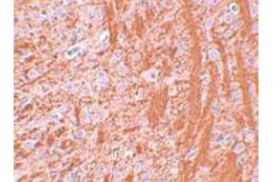 Immunohistochemical staining of rat brain tissue with 2. (JMJD6 anticorps  (N-Term))