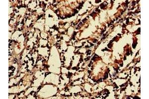 Immunohistochemistry of paraffin-embedded human appendix tissue using ABIN7142858 at dilution of 1:100 (NUDT1 anticorps  (AA 49-82))