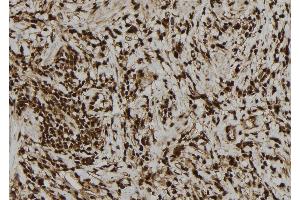 ABIN6277757 at 1/100 staining Human gastric tissue by IHC-P. (PVALB anticorps  (C-Term))