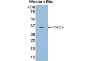 Detection of Recombinant LSR, Human using Monoclonal Antibody to Lipolysis Stimulated Lipoprotein Receptor (LSR)