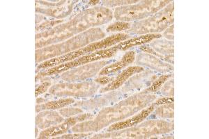 Immunohistochemistry of paraffin-embedded human colon carcinoma using [KO Validated] SQSTM1/p62 Rabbit mAb (ABIN7270205) at dilution of 1:100 (40x lens).
