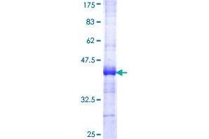 Image no. 1 for Acetyl-CoA Carboxylase alpha (ACACA) (AA 1-99) protein (GST tag) (ABIN1305570)