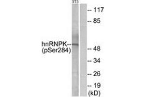 Western blot analysis of extracts from NIH-3T3 cells treated with EGF 200ng/ml 30', using hnRNP K (Phospho-Ser284) Antibody. (HNRNPK anticorps  (pSer284))