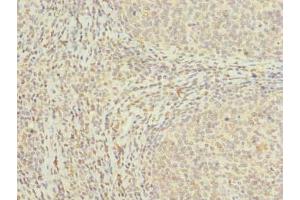Immunohistochemistry of paraffin-embedded human tonsil tissue using ABIN7159116 at dilution of 1:100 (MED18 anticorps  (AA 35-208))