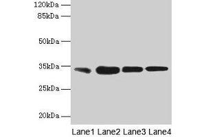 Western blot All lanes: RAD23A antibody at 3 μg/mL Lane 1: MCF-7 whole cell lysate Lane 2: Hela whole cell lysate Lane 3: Raji whole cell lysate Lane 4: Jurkat whole cell lysate Secondary Goat polyclonal to rabbit IgG at 1/10000 dilution Predicted band size: 40, 34 kDa Observed band size: 34 kDa (RAD23A anticorps  (AA 2-201))