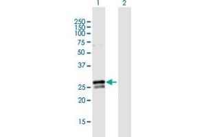 Western Blot analysis of RAB3B expression in transfected 293T cell line by RAB3B MaxPab polyclonal antibody. (RAB3B anticorps  (AA 1-219))