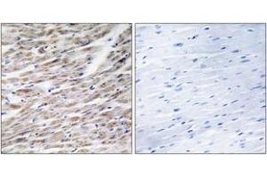 Immunohistochemistry analysis of paraffin-embedded human heart tissue, using GRAA Antibody.