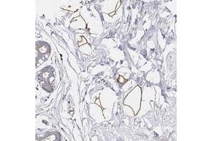 Immunohistochemical staining of human breast with C19orf12 polyclonal antibody  shows strong positivity in adipocytes at 1:50-1:200 dilution. (C19ORF12 anticorps)