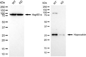anti-Hippocalcin (HPCA) antibody