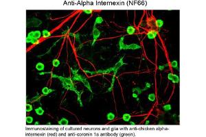 Immunohistochemistry of Anti-Alpha Internexin (chicken) Antibody - 200-901-D04 Immunohistochemistry of Anti-Alpha Internexin (chicken) Antibody.