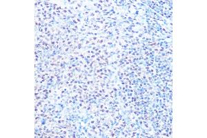 Immunohistochemistry of paraffin-embedded rat spleen using SNRPB Rabbit pAb (ABIN6134519, ABIN6148214, ABIN6148215 and ABIN6219175) at dilution of 1:100 (40x lens). (SNRPB anticorps  (AA 1-100))
