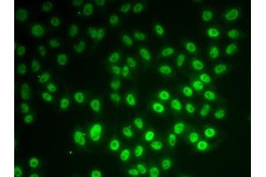 Immunofluorescence analysis of MCF7 cell using SNRPD1 antibody. (SNRPD1 anticorps)