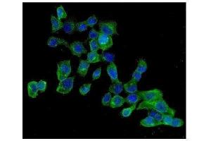 anti-Protein Kinase, AMP-Activated, beta 2 Non-Catalytic Subunit (PRKAB2) (AA 56-89), (N-Term) antibody