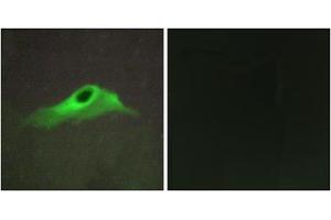 Immunofluorescence analysis of HeLa cells, using COL4A5 antibody. (COL4a5 anticorps  (N-Term))