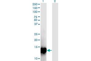 Western Blot analysis of C17orf37 expression in transfected 293T cell line by C17orf37 monoclonal antibody (M09), clone 4D4. (C17orf37 anticorps  (AA 1-115))