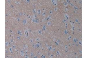 Detection of SIRPa in Human Cerebrum Tissue using Polyclonal Antibody to Signal Regulatory Protein Alpha (SIRPa)