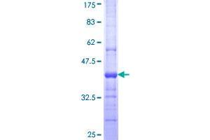 Image no. 1 for Phospholipase A2, Group XV (PLA2G15) (AA 314-412) protein (GST tag) (ABIN1315275)