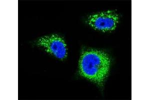 Confocal immunofluorescent analysis of TrkA antibody with MDA-MB231 cells followed by Alexa Fluor 488-conjugated goat anti-rabbit lgG (green).