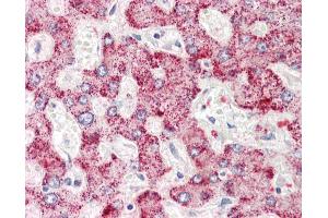 Anti-AIG1 antibody IHC staining of human liver. (AIG1 anticorps  (N-Term))