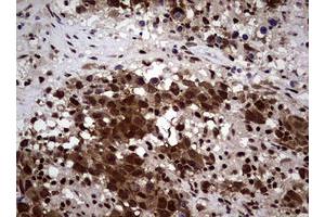 Image no. 8 for anti-Nibrin (NBN) (AA 183-460) antibody (ABIN1491058)