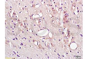 Formalin-fixed and paraffin embedded rat brain tissue labeled with Anti-CD54/ICAM-1 Polyclonal Antibody (ABIN670806), Unconjugated at 1:200, followed by conjugation to the secondary antibody and DAB staining (ICAM1 anticorps  (AA 201-300))