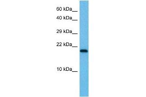 Host:  Mouse  Target Name:  UBE2I  Sample Tissue:  Mouse Testis  Antibody Dilution:  1ug/ml (UBE2I anticorps  (N-Term))