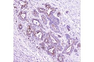 IHC analysis of TANK using anti-TANK antibody (ABIN6719508). (TANK anticorps)
