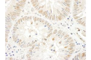 Immunohistochemistry (IHC) image for anti-Nucleolar and Coiled-Body Phosphoprotein 1 (NOLC1) (AA 1-50) antibody (ABIN7454437)