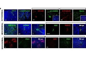 Multi-lineage differentiation capabilities of OCT4-overexpressing cancer cells (OTBCs). (KRT14 anticorps)