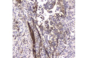 IHC analysis of MAP1LC3A using anti-MAP1LC3A antibody .