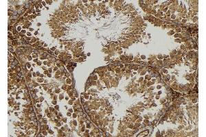 ABIN6277106 at 1/100 staining Mouse testis tissue by IHC-P. (SYK anticorps)