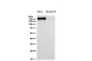All lanes use the Antibody at 1:1K dilution for 1 hour at room temperature.
