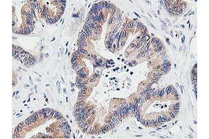 Image no. 10 for anti-Leucine Carboxyl Methyltransferase 1 (LCMT1) antibody (ABIN1499107) (LCMT1 anticorps)