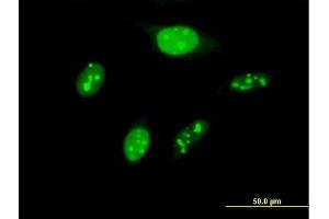 Immunofluorescence of purified MaxPab antibody to BYSL on HeLa cell. (Bystin-Like anticorps  (AA 1-437))