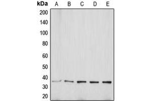 Western blot analysis of Aquaporin 5 expression in MCF7 (A), Jurkat (B), SP2/0 (C), PC12 (D), KNRK (E) whole cell lysates. (Aquaporin 5 anticorps  (C-Term))