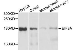 Western blot analysis of extracts of A2058 cell line, using EIF3A antibody.