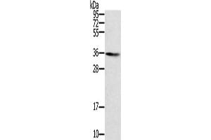Gel: 8 % SDS-PAGE, Lysate: 40 μg, Lane: Human normal liver tissue, Primary antibody: ABIN7131123(SNX11 Antibody) at dilution 1/300, Secondary antibody: Goat anti rabbit IgG at 1/8000 dilution, Exposure time: 5 minutes (SNX11 anticorps)