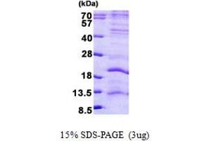 SDS-PAGE (SDS) image for L Antigen Family, Member 3 (LAGE3) (AA 1-143) protein (His tag) (ABIN6387163)