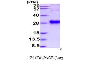 SDS-PAGE (SDS) image for Insulin-Like Growth Factor Binding Protein 6 (IGFBP6) (AA 26-238) protein (His tag) (ABIN5854662)