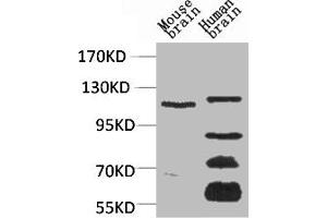 Western blot analysis of 1) Mouse Brain Tissue, 2)Human Brain Tissue, with CaVα2δ3 Rabbit pAb diluted at 1:2,000. (CACNA2D3 anticorps)