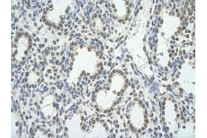 Rabbit Anti-BRD7 antibody         Paraffin Embedded Tissue:  Human Lung    cell Cellular Data:  alveolar cell    Antibody Concentration:  4. (BRD7 anticorps  (C-Term))