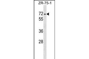 ZKSCAN1 Antibody (Center) (ABIN1538154 and ABIN2848860) western blot analysis in ZR-75-1 cell line lysates (35 μg/lane). (ZKSCAN1 anticorps  (AA 238-265))